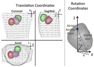 Tracking the Position of the Heart From Body Surface Potential Maps and Electrograms